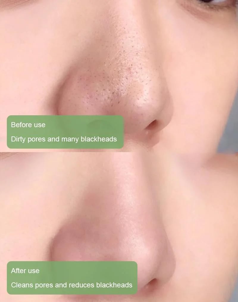 🔥Deep Cleanse Green Tea plant cleaning paste